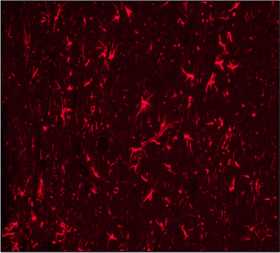GFAP staining in rat brain from EAE model